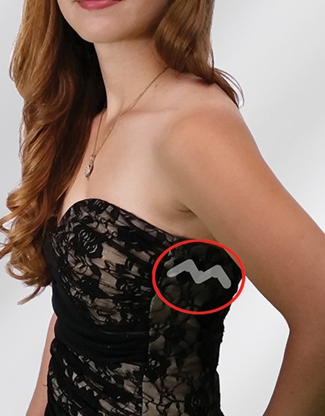 Braza UPSIE DAISIE - BANDES ADHESIVES POUR VETEMENTS